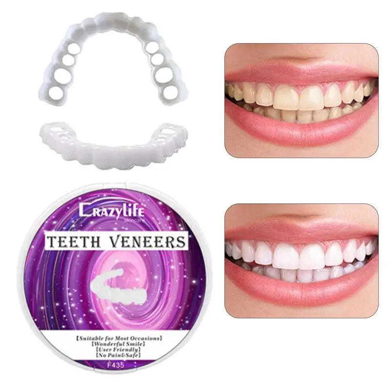 

Veneers Teeth Instant Veneers For Temporary Tooth Repair Upper And Lower Jaw Realistic Dental Veneers For Temporary Teeth