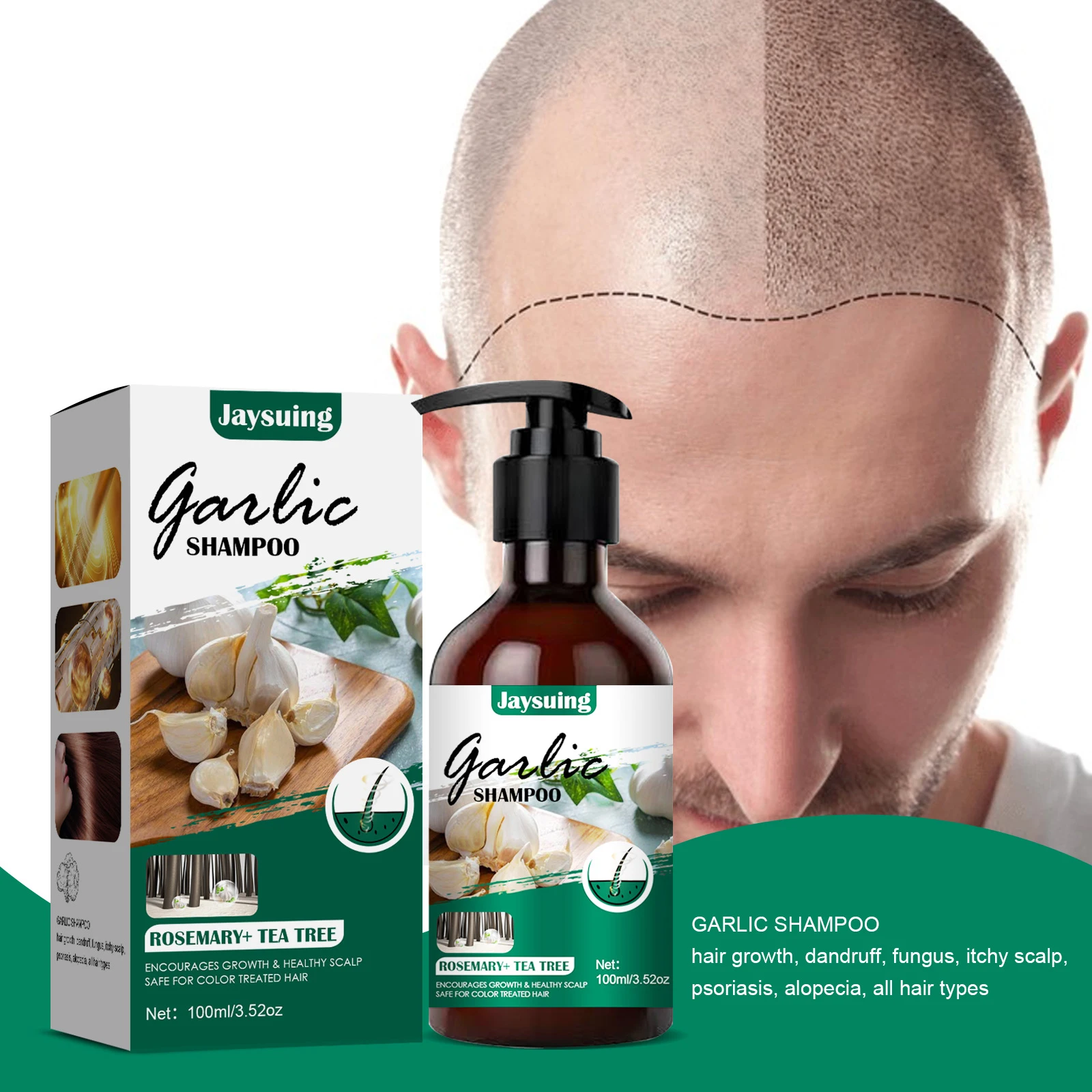 

100ml Liquid Garlic Hair Growth Shampoo Anti Hair Loss Hair Growth Serum Effective Dandruff Shampoo Hair Loss Prevention Essence