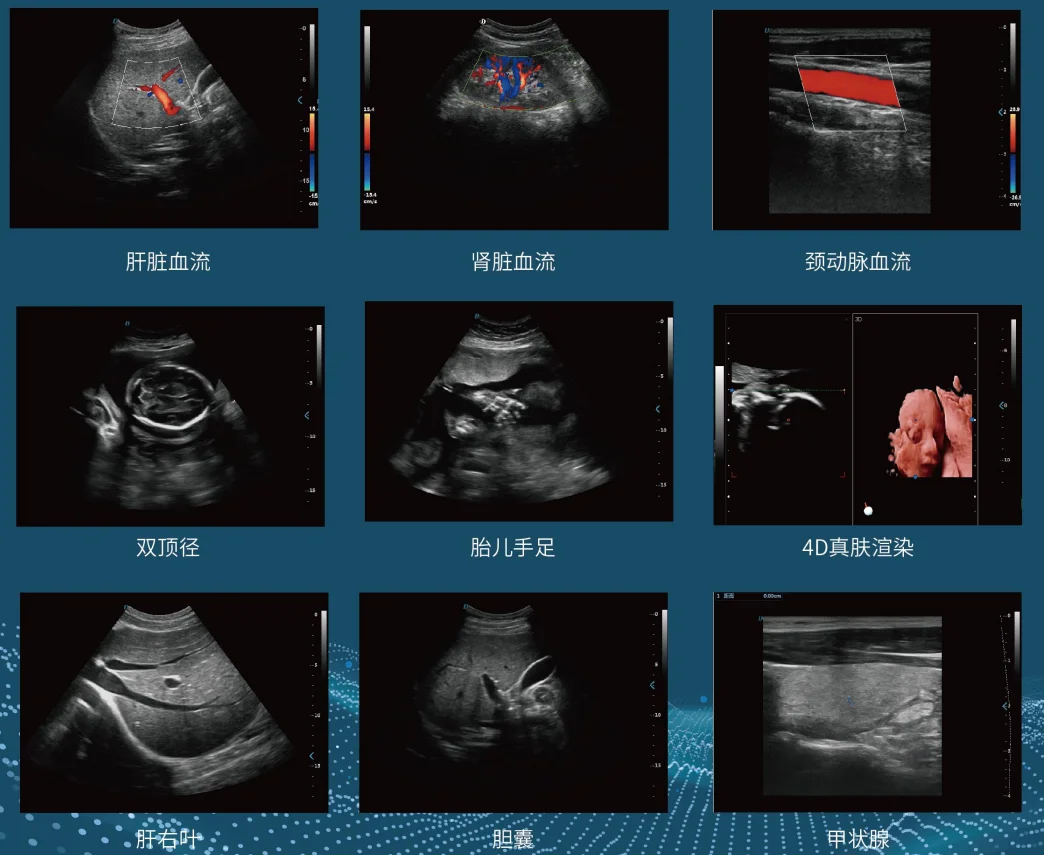 Рисунок 5 - Допплеровский инструмент для тестирования
