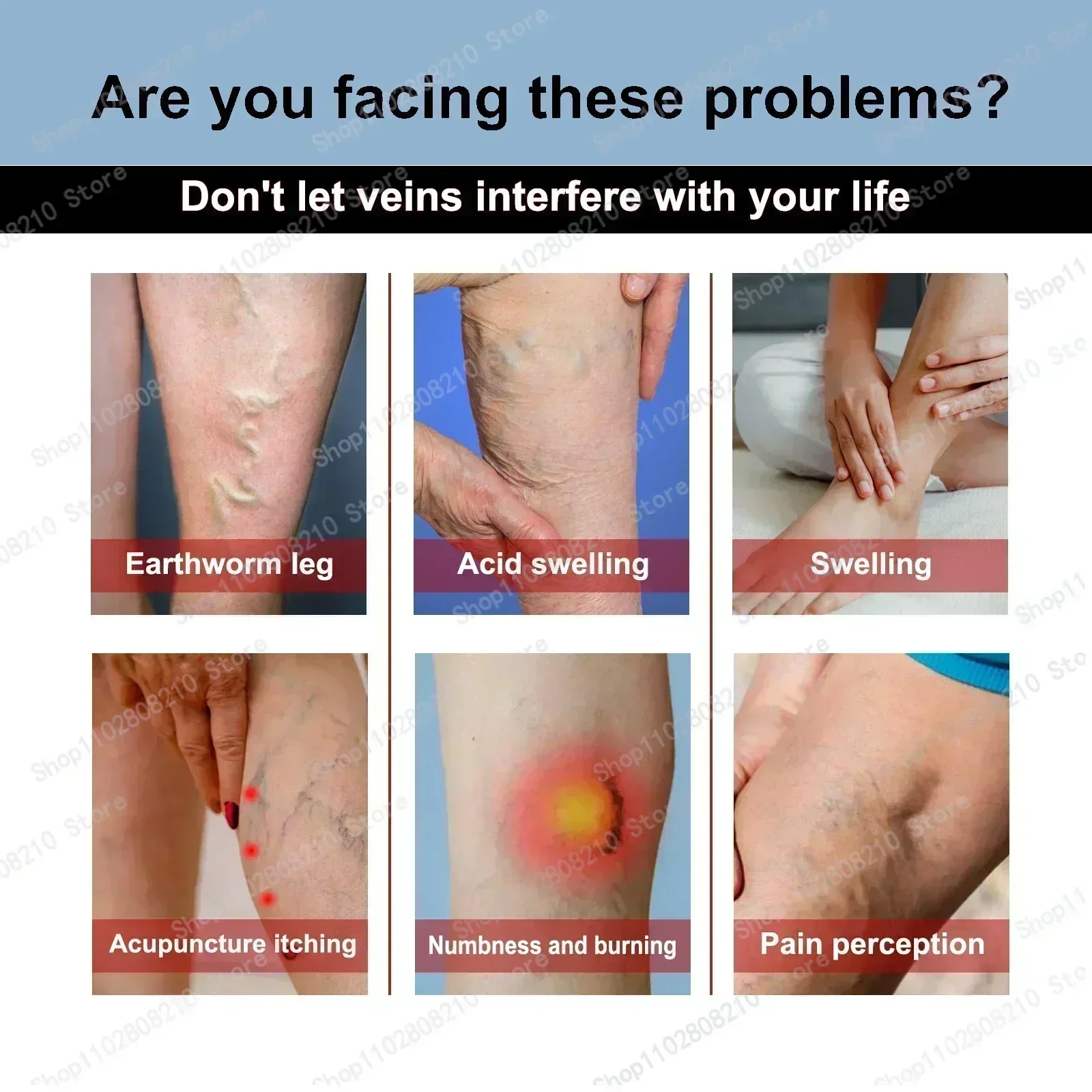 Псориаз дерматит экзема гадание грибка против зуда успокаивающий местный крем