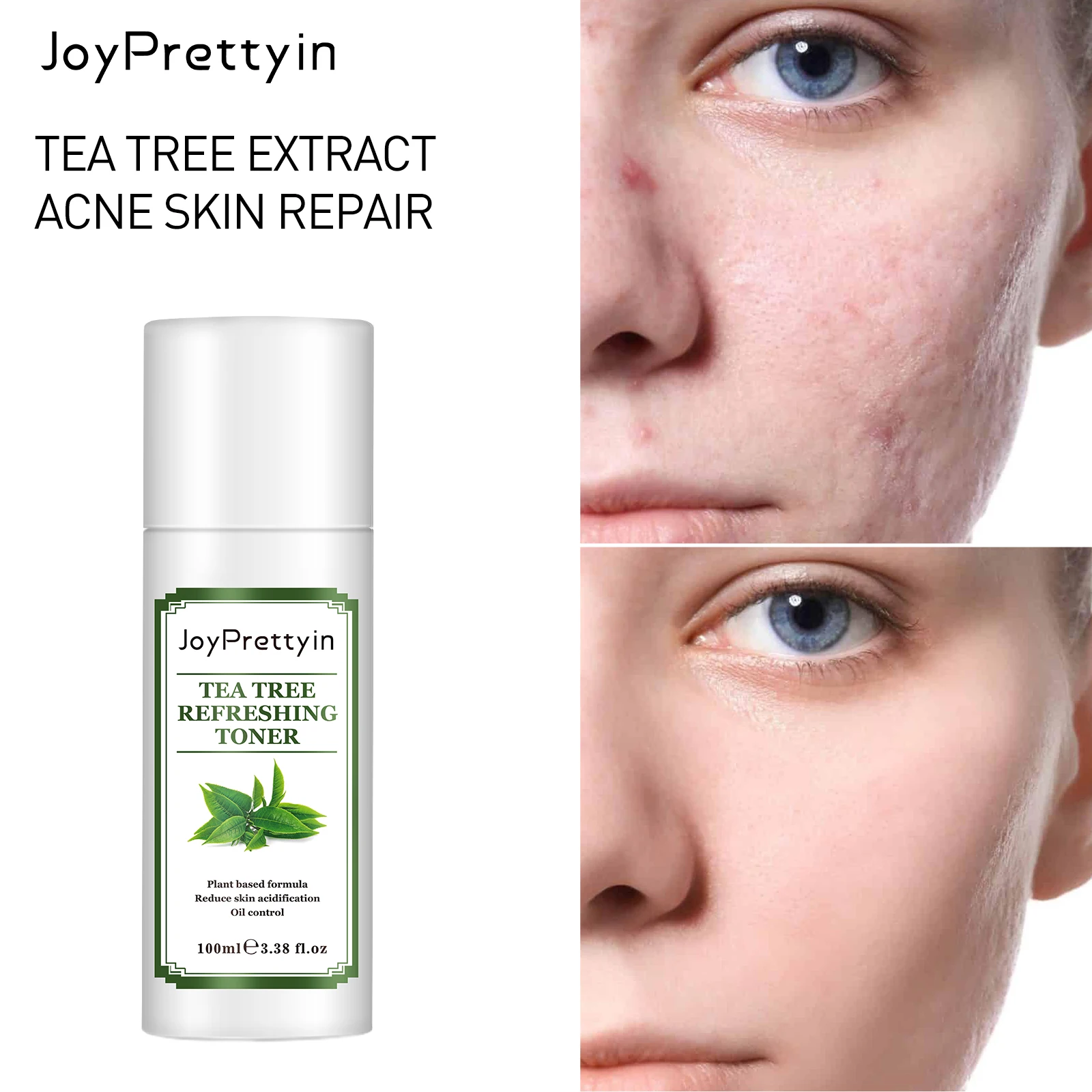 

JoyPrettyin Tea Tree Toner Refreshing Skin Care Moisturizing Oil Control Facial Acne Treatment Hydrating Toner 100ml
