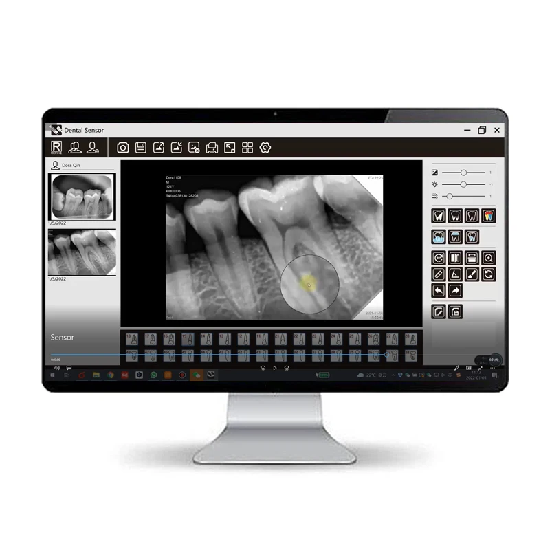 

High Resolution Images X Ray Sensor Dental