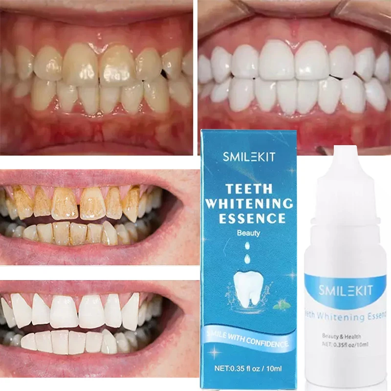 Teeth Whitening Essence Remove Plaque Stains Mint Serum Oral Hygiene Bleaching Products Cleansing Fresh Breath Tooth Care Tools