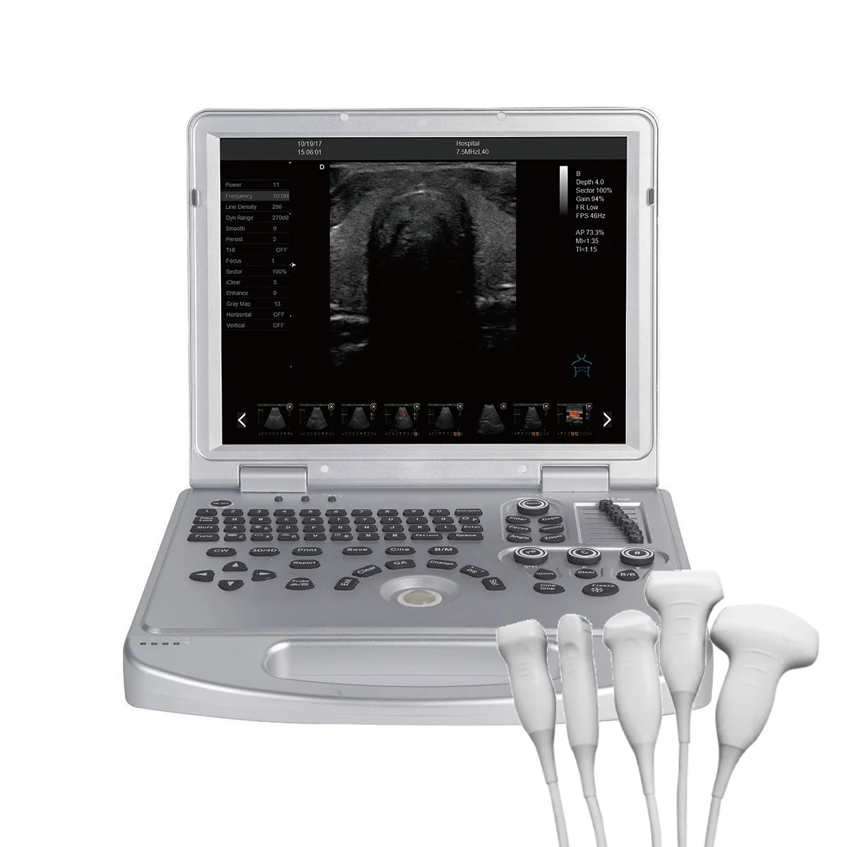 

Best selling L5 handy Portable Pet Ultrasound 3D 4D PW Color Doppler Ultrasound