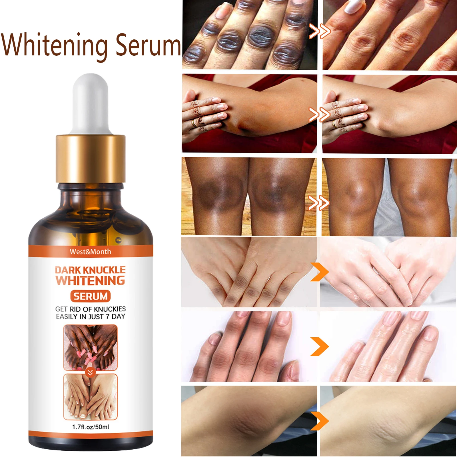 

Отбеливающая Сыворотка для тела, крем для фотопигментации, улучшает долгий рост даже кожи, осветляет внутреннюю поверхность бедер, интимна...