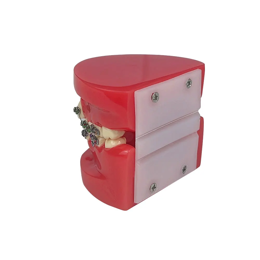 Стоматологическая ортодонтическая модель лечение зубов стандартная обучающая