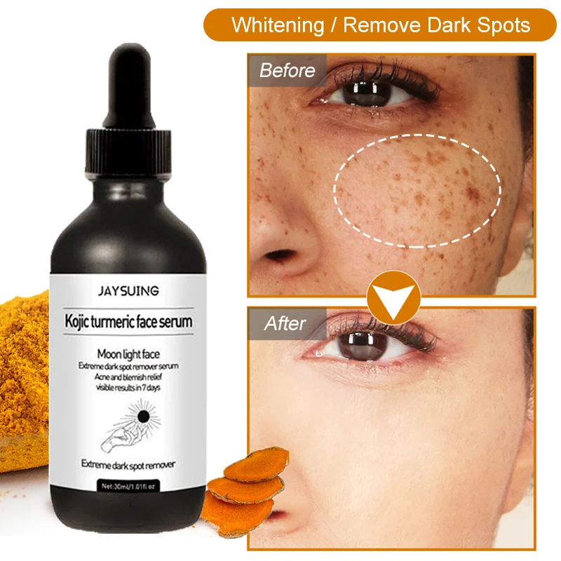 

Turmeric Oil Freckle Whitening Face Serum Fade Dark Spots Brighten Removal Pigment Melanin Correcting Nourish Essence Skin Care