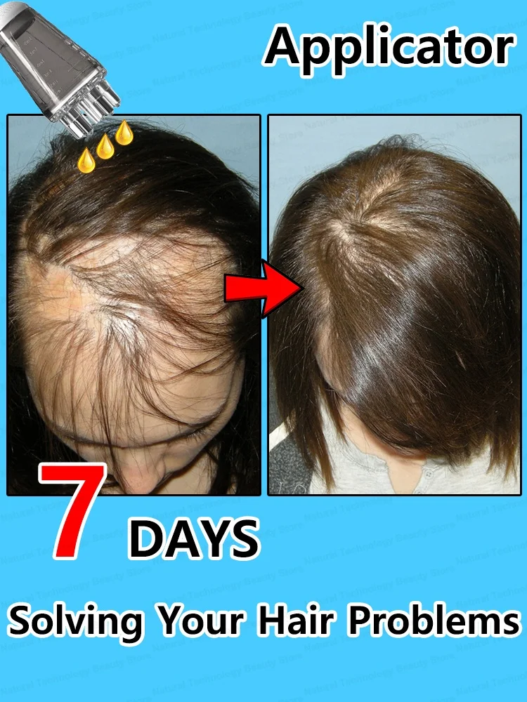 Выразите ваши проблемы на волосы