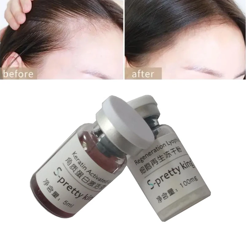 

2 шт./компл. густые волосы на стволовых клетках 28 дней Сыворотка для быстрого роста против выпадения волос Восстановление фолликулов стимул...