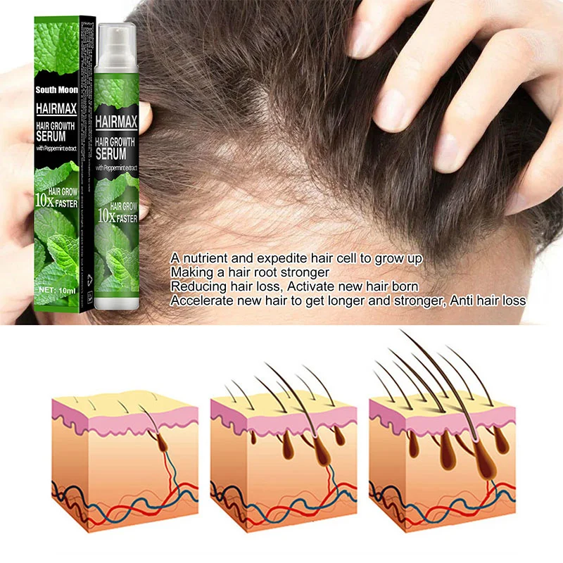 

Спрей травяной для быстрого роста волос, сыворотка против выпадения волос, эссенция для восстановления роста волос, жидкое средство для ист...