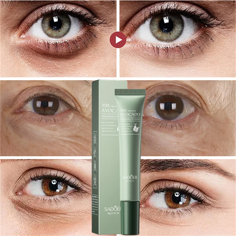Remove Dark Circles Eye Cream Anti-Wrinkle Fade Fine Lines Moisturizing Relieving Dry Skin Remove Eye Bags Puffiness Eye Care