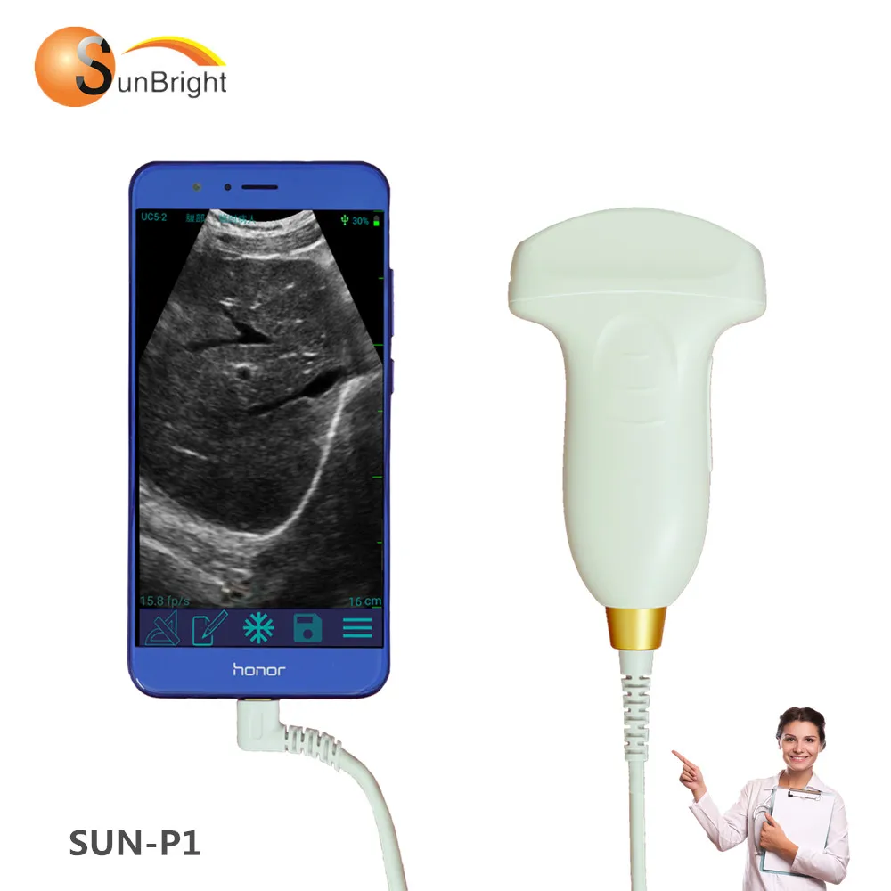 

Portable Medical Ultrasound Instruments Convex USB Ultrasound Best Price