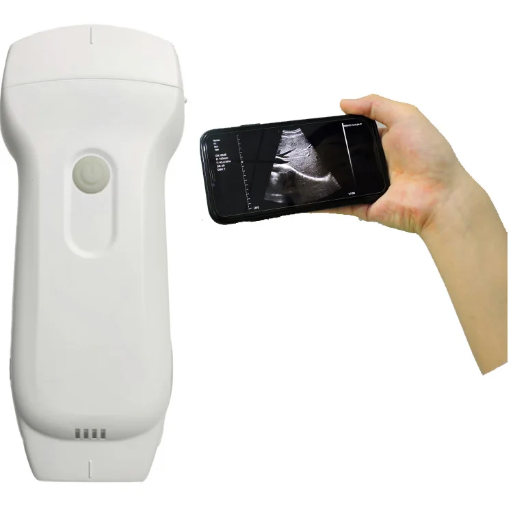 

High quality 128 elements wireless portable ultrasound 3 in 1 prode can be used to cheak up vascular,carotid and so on