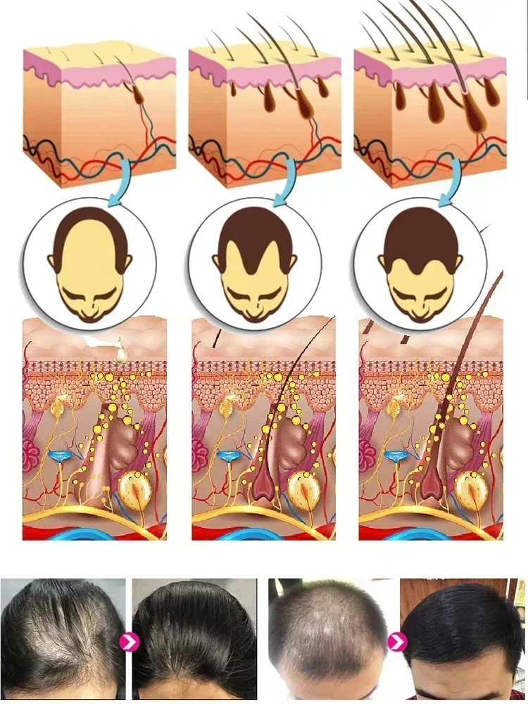 Рост волос для мужчин и женщин имбирное натуральное масло роста уход за волосами