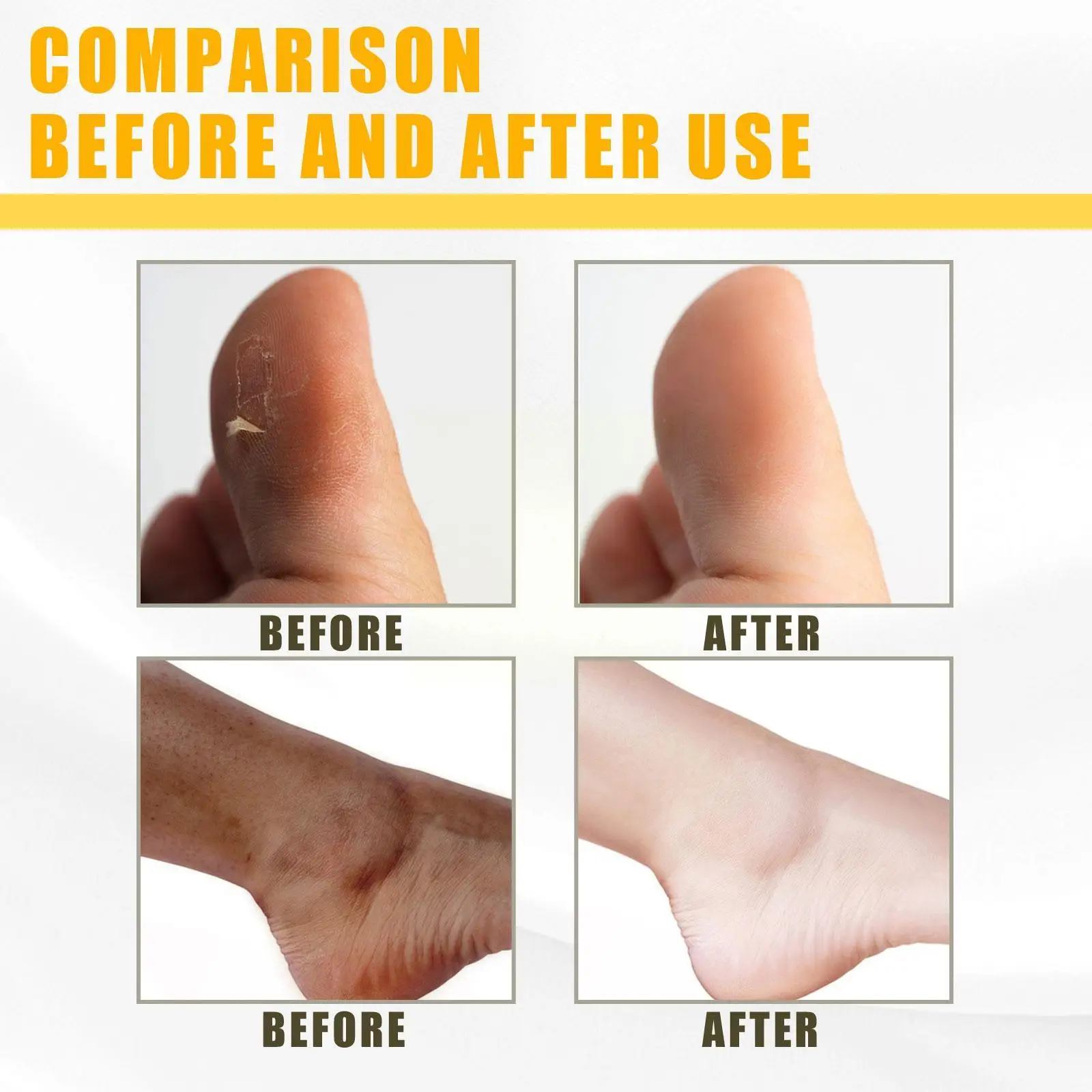 Butter Exfoliating Melanin Smooth Brightening Complexion Clean Facial Knee Hands Black Acid Fruit D K1C1 |