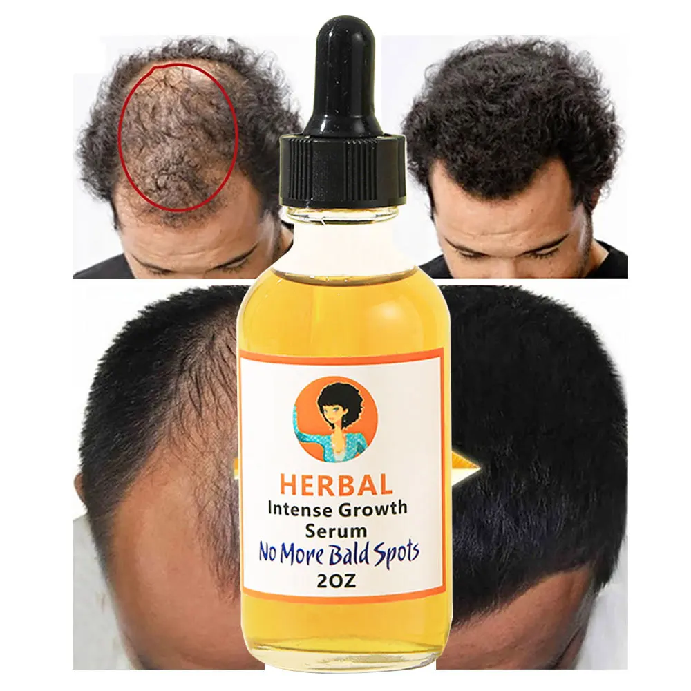

Sdotter 2pcs Hair Care Hair Growth Essential Oils Essence Original Authentic Hair Loss Liquid Health Care Beauty Dense Hair Grow