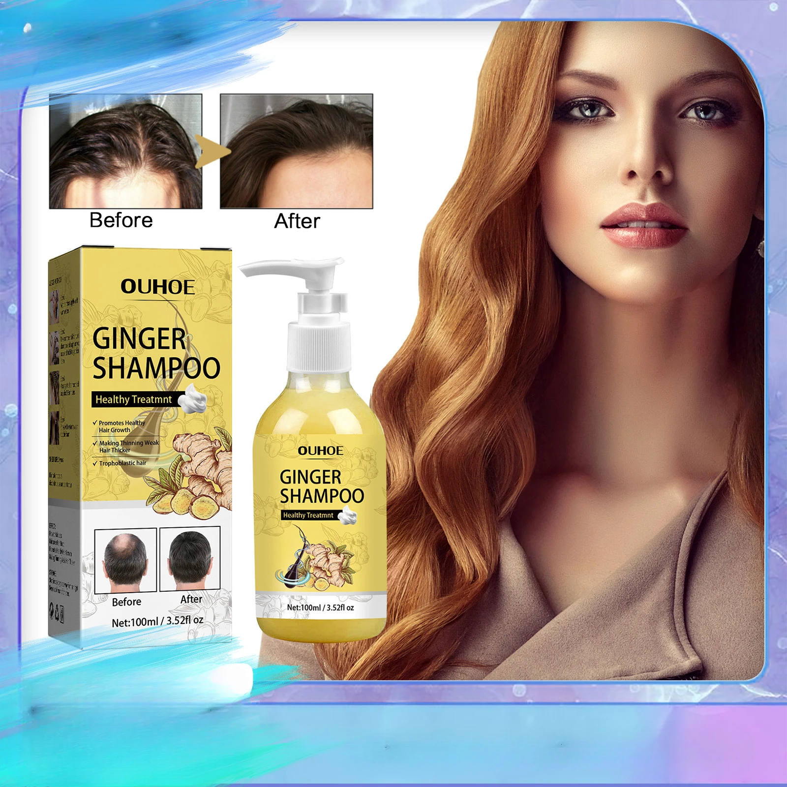 Шампунь для роста волос против выпадения зуд лечение кожи головы глубокая