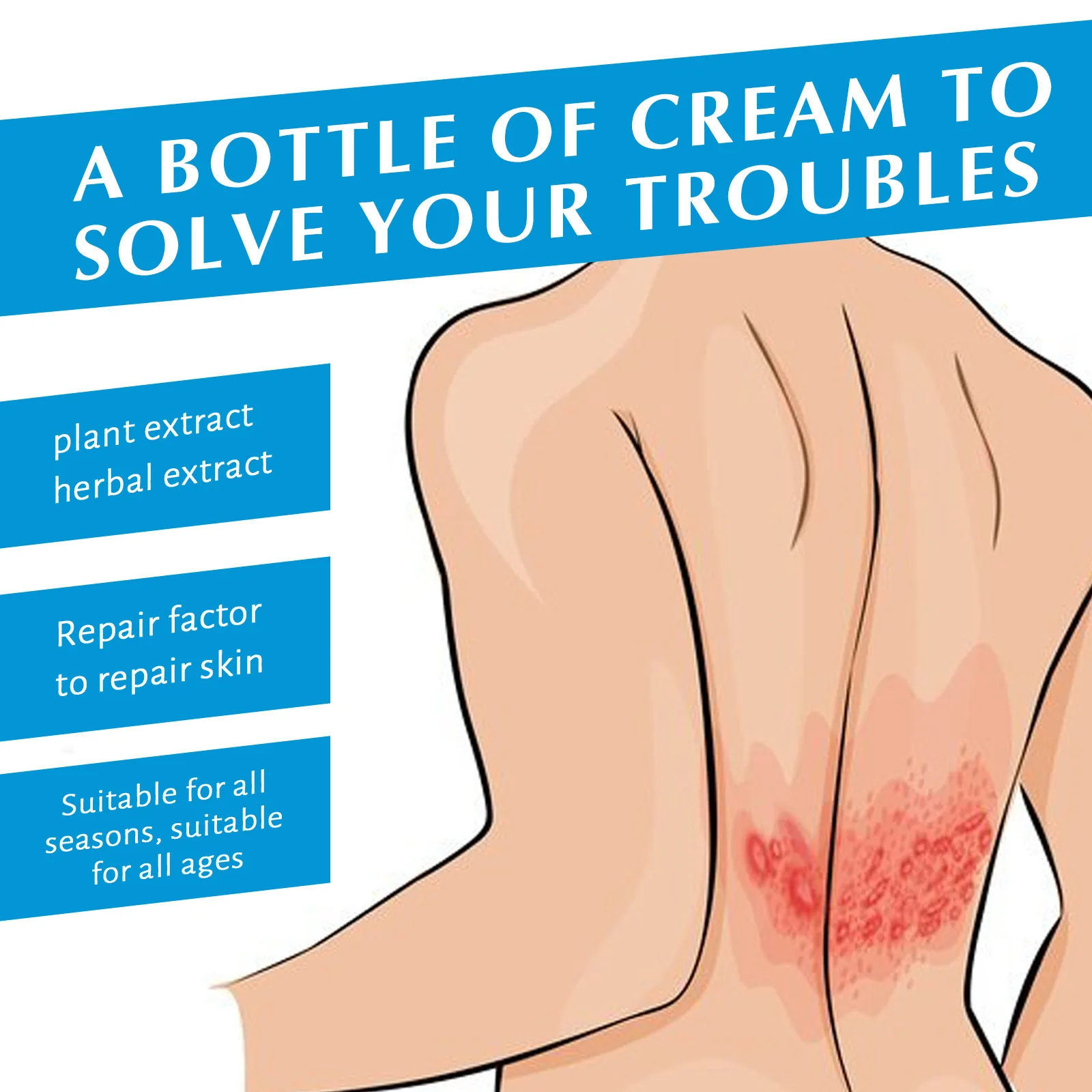 Крем от псориаза витамин B12 лечение дерматита экзематоида антибактериальный