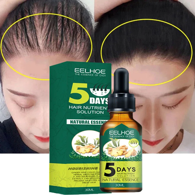 

5 Days Ginger Hair Growth Essential Oil Products Anti Hair Loss Serum Fast Growing Nourish Soften Scalp Repair Damaged Hair Care