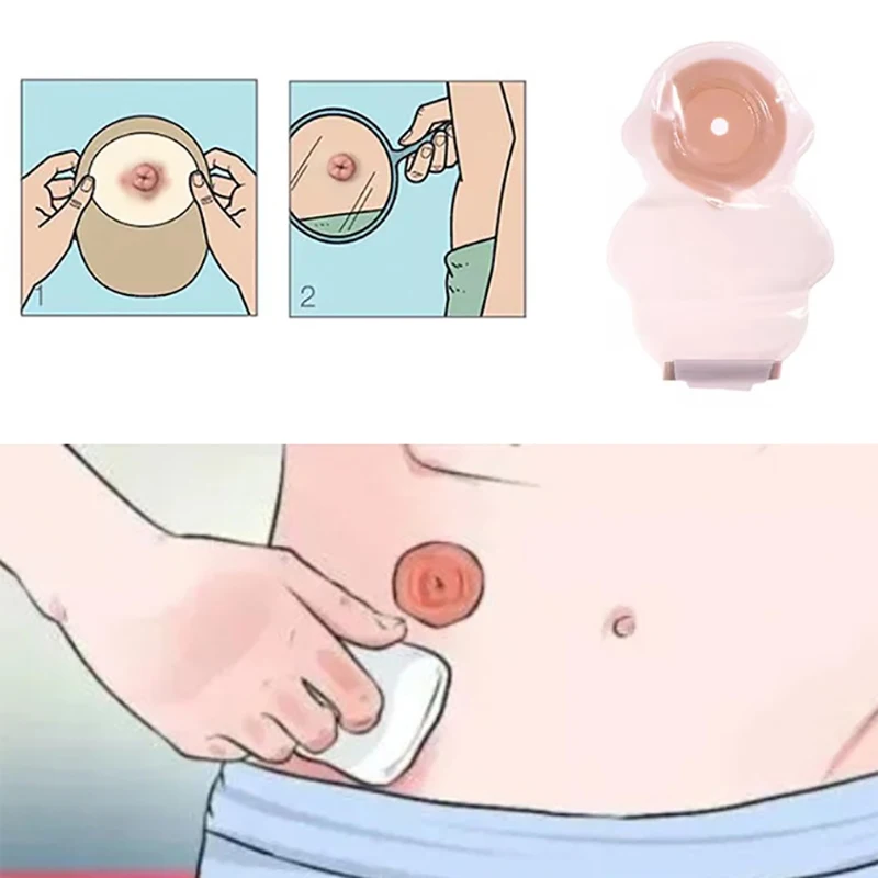 1 шт. детский цельный дренажный мешок для колостомы портативная липкая застежка