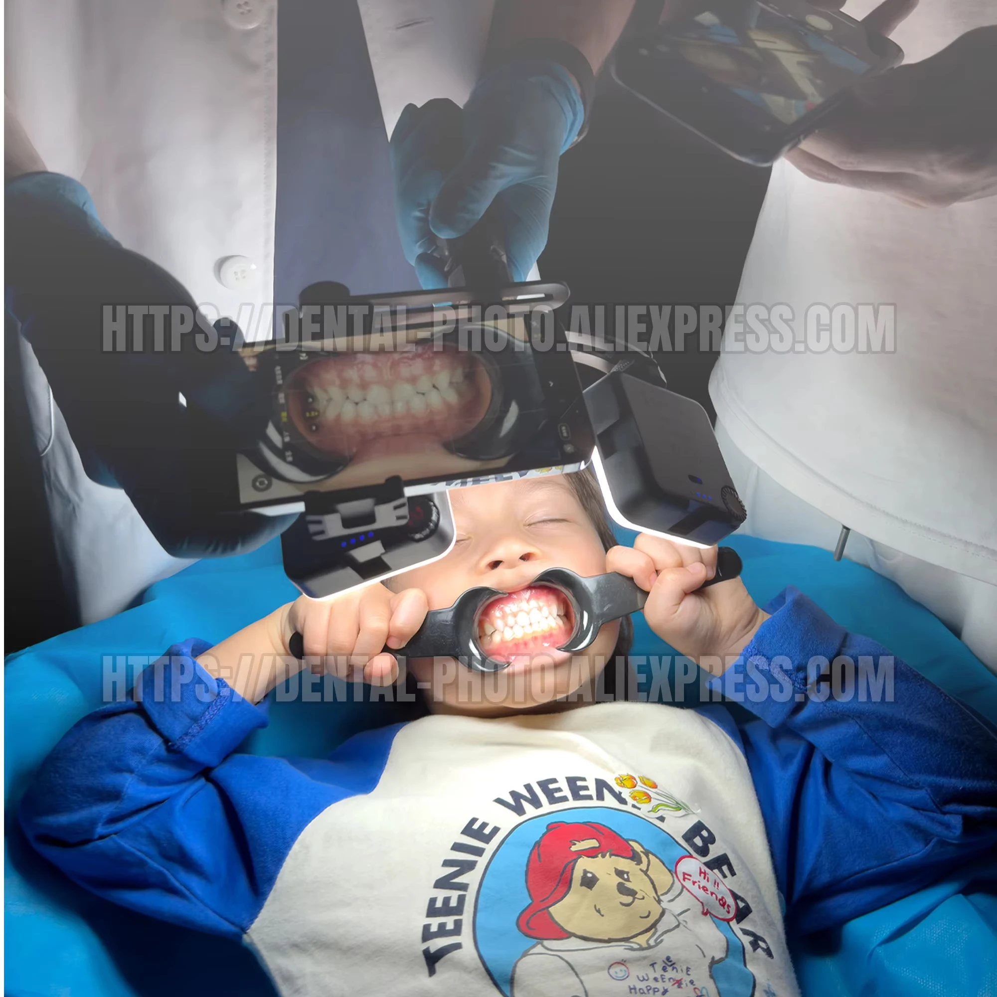 Фото Комплект для стоматологической фотосъемки на смартфон MK-019W: вертикальные и горизонтальные съемки ротовой полости, фото и видео без бликов для зубов и протезов №4