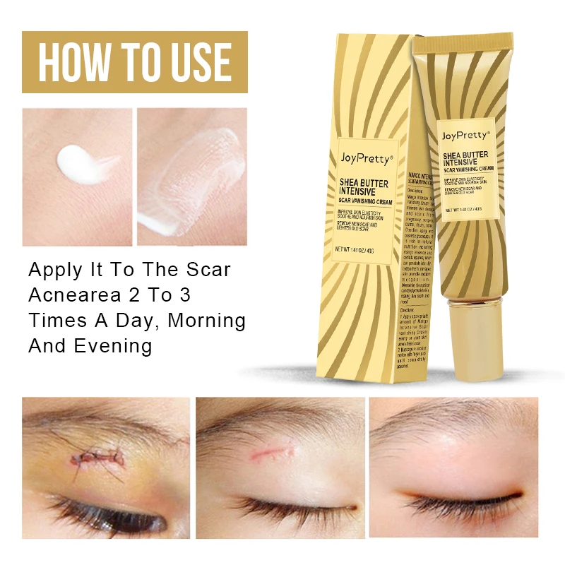

Scar Removal Cream Acne Pimple Mark Burn Scars Remover Mango Intensive Face Repair Enhance Elasticity Smooth Skin Care