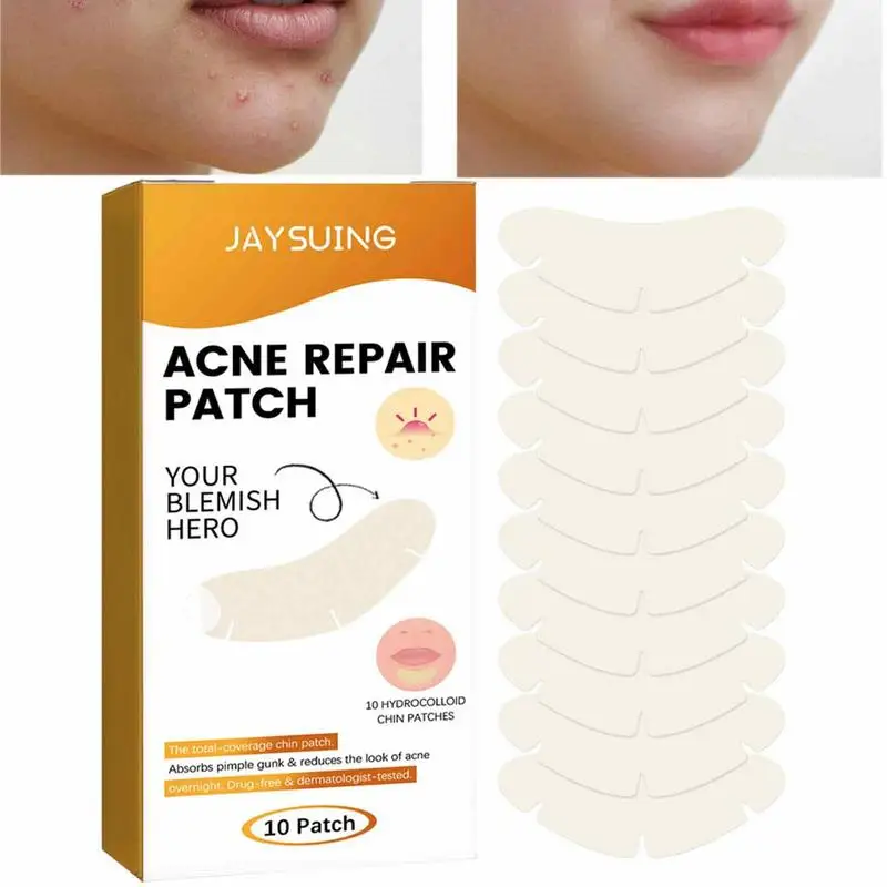 

Гидроколлоидные патчи на акне, 10 упаковок, патчи на акне и наклейки на прыщи, точки акне для покрытия пятен и пятен, наклейки на пятна