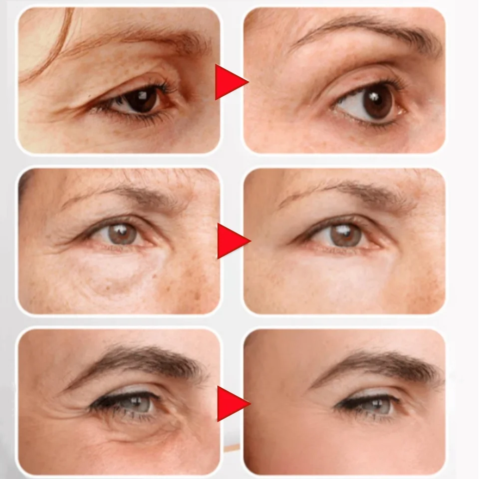 Крем для области вокруг глаз от морщин припухлости и тёмных кругов