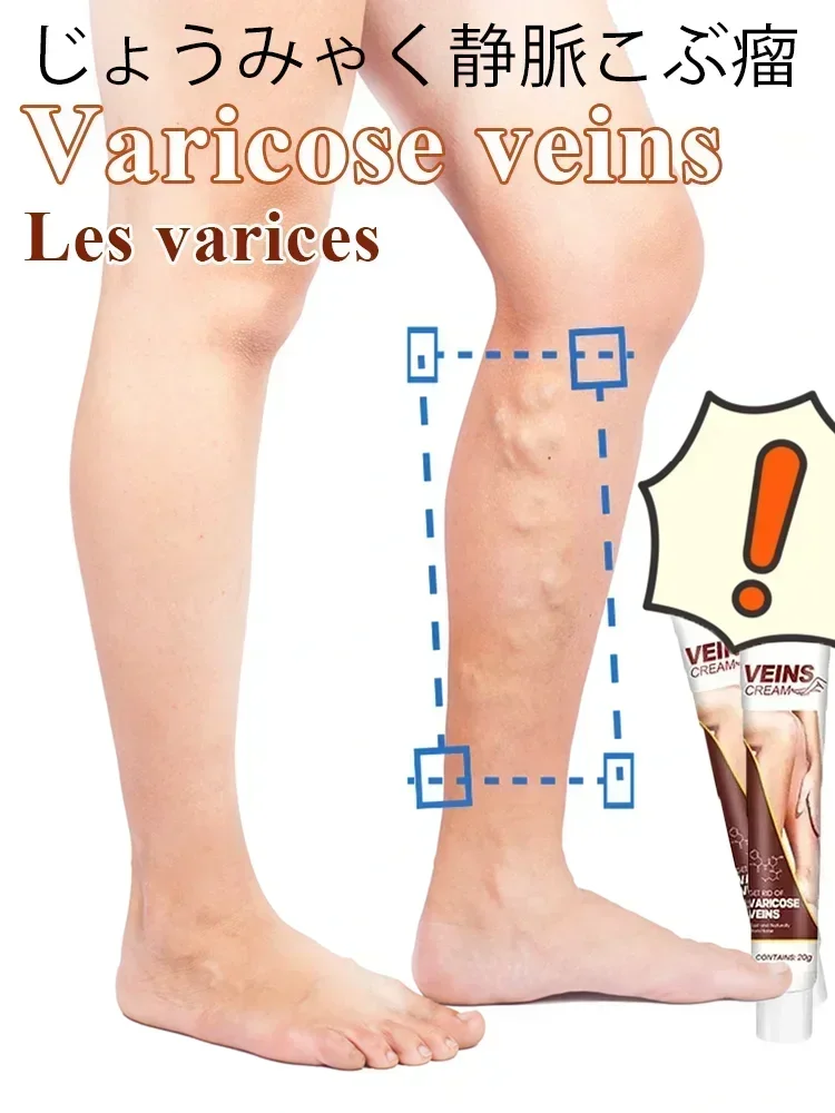 Эффективный крем для облегчения варикозного расширения вен мазь васкулита