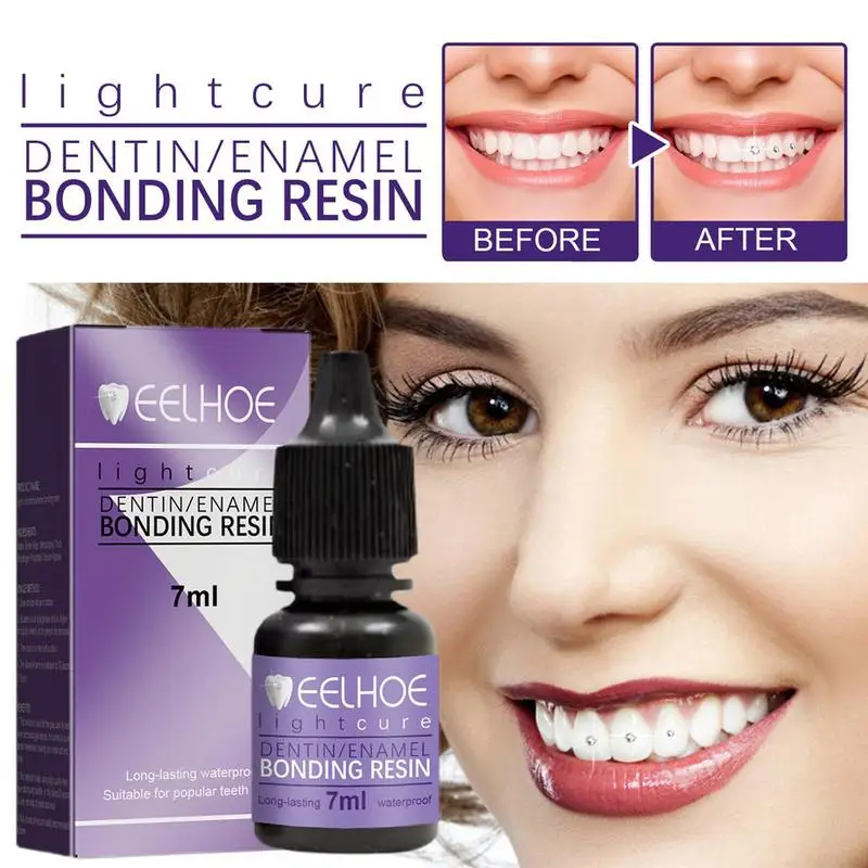 

Клей для зубных камней, клей для зубных камней, 7 мл, клей для драгоценных камней, Алмазный кристалл, украшение для ювелирных изделий, композитный агент для склеивания смолы