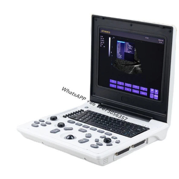 

Obstetrics and Gynecology of Fetal Abortion probe ultrasonic black and white portable ultrasound machine