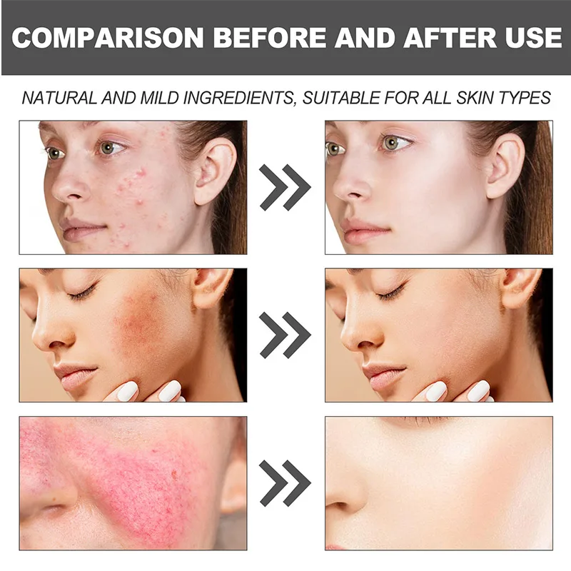 Стойкий питательный увлажняющий крем Centella Asiatica осветляет подтягивает тон кожи