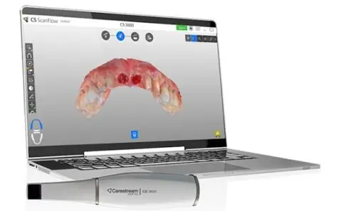 

Complete Set Intraoral Digital Handheld Scanner 3D Aoralscan 3 Dental+15' Laptop