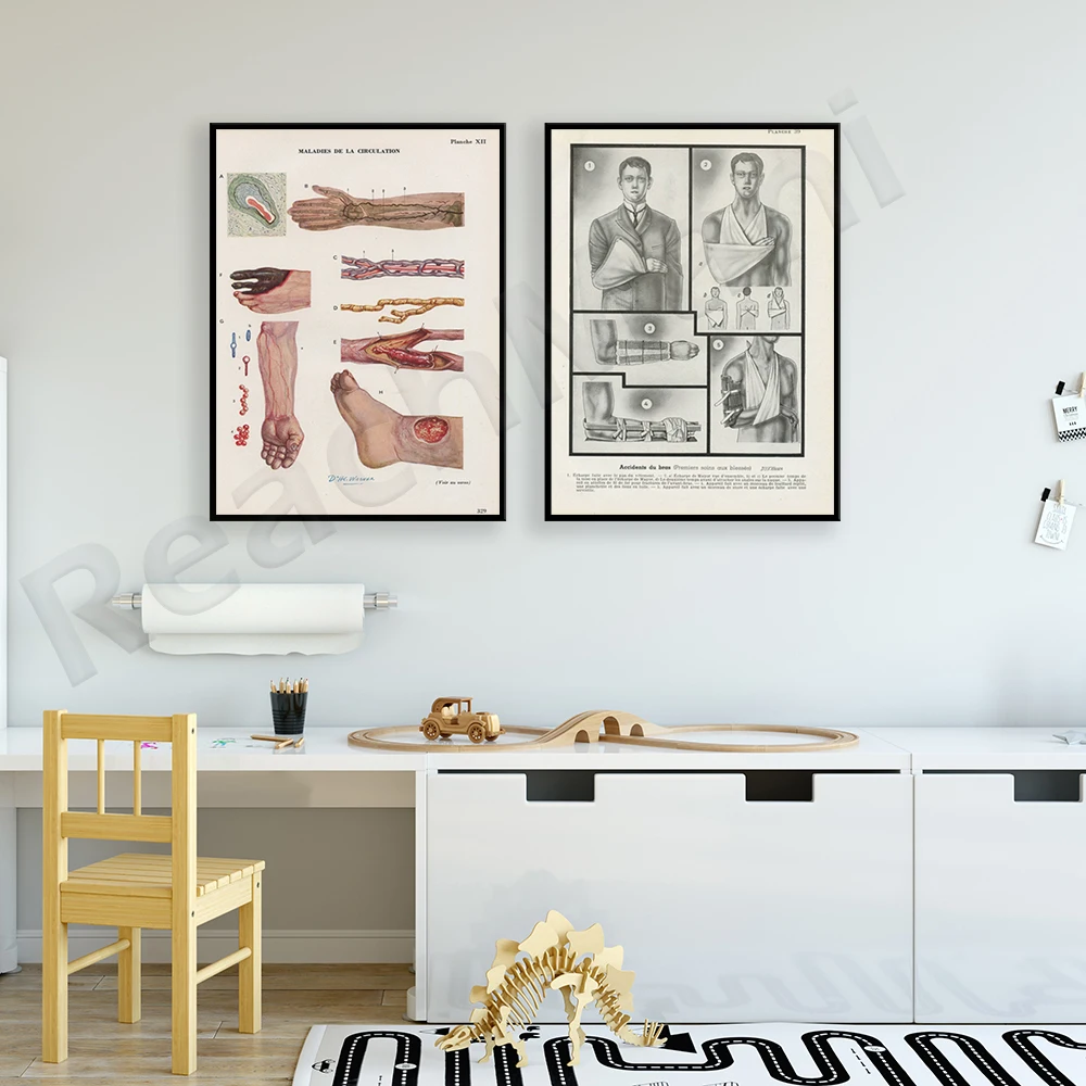 

Blood circulation anatomy, forearm emergency medical poster. Emergency gifts for doctors, students, nurses, paramedics