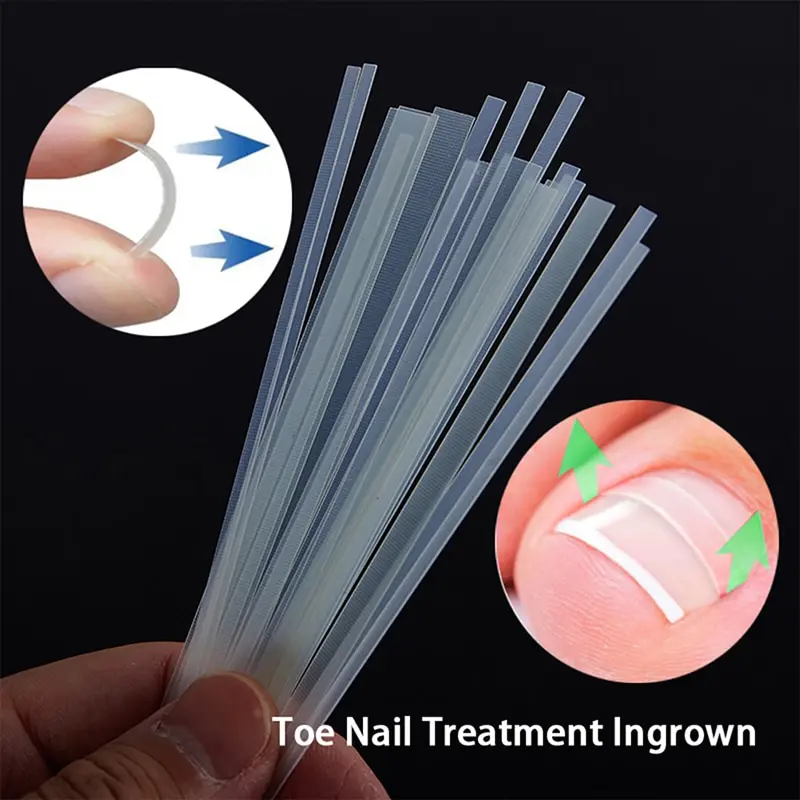 

5pcs Ingrown Toe Nail Treatment Ingrown Toenail Correction Tool Elastic Patch Sticker Straightening Clip Brace Pedicure Tools