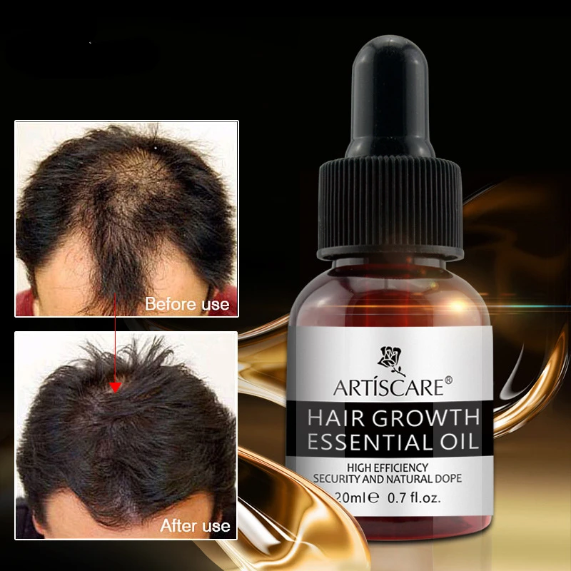 

Ginger Hair Growth Essence Oils Products Anti Hair Loss Treatement Fast Growing Germinal Serum Prevent Scalp Damaged Men Women