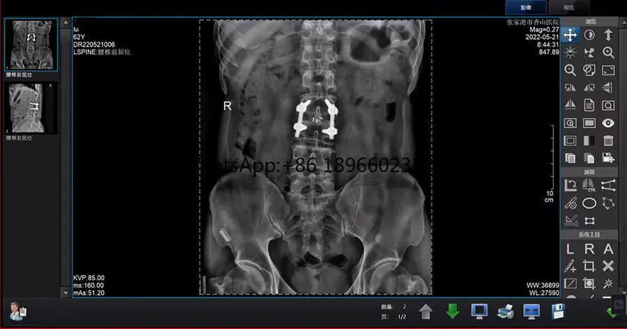 Медицинское рентгенографическое оборудование рентгенологическое провод CSI 17*17 XV