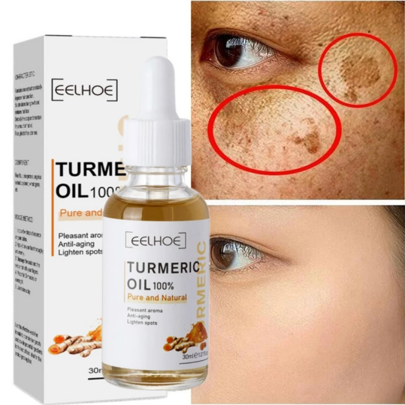 

Turmeric Whitening Melasma Correcting Serum Freckle Dark Spot Remove Facial Care Essence Oil Brighten Skin Fade Pigment Melanin