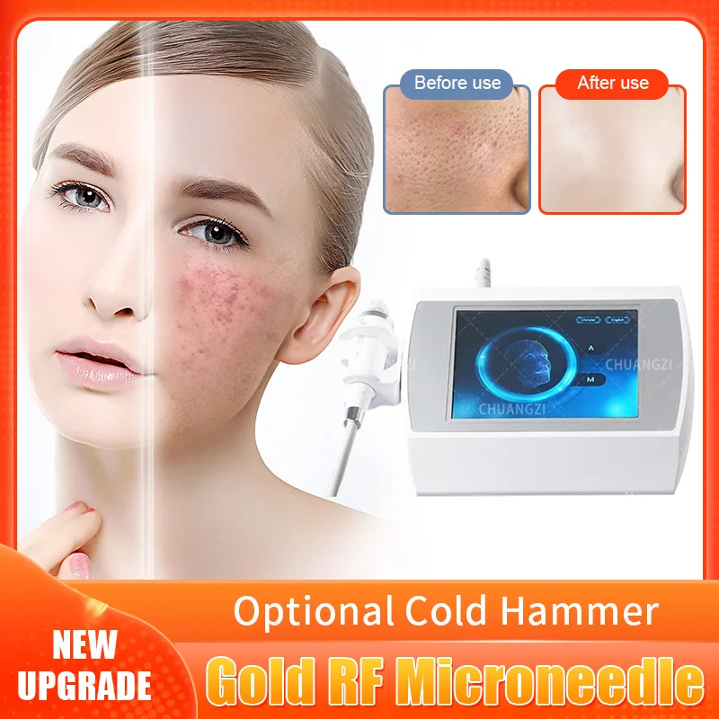 

2023 Newest Maximum Power RF MicroNeedle Facial Skin Care Machine RF Acne Scar Stretch Mark Removal Beauty Equipment For Salon