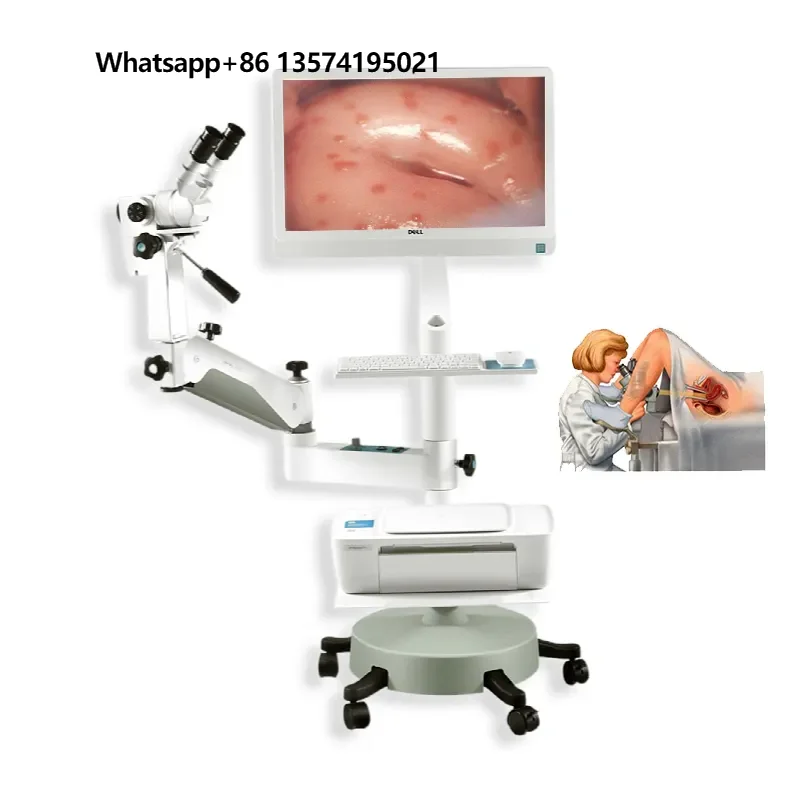 CE 510K KERNEL KN-2200BI Бинокулярное оптическое видео для гинекологии
