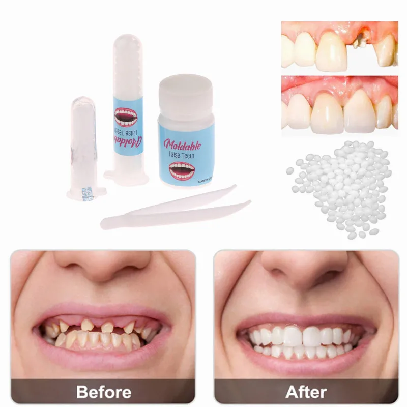 

Temporary Filling Teeth Glue False Filling Cavity Broken Teeth Teeth Gap Filling Solid Glue Particles Can Be Shaped Teeth Glue