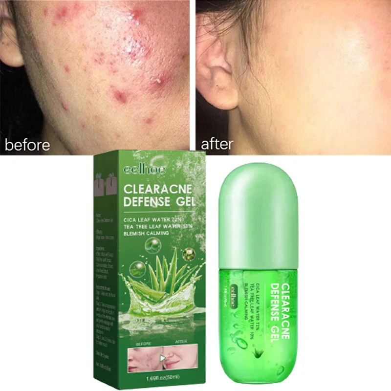 

50ml Aloe Vera Gel Acne Treatment Face Serum Pore Shrinking Pimple Dark Spot Remover Moisturizing Cream Korean Skin Care Product