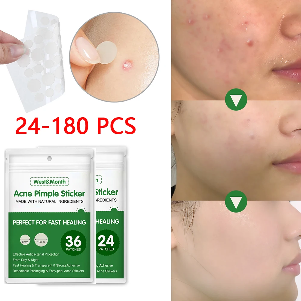 24-180 PCS Patches Beauty Acne tools Acne Patch Set Skin Tag Remover Pimple Master Hydrocolloid Patch Face Skin Care