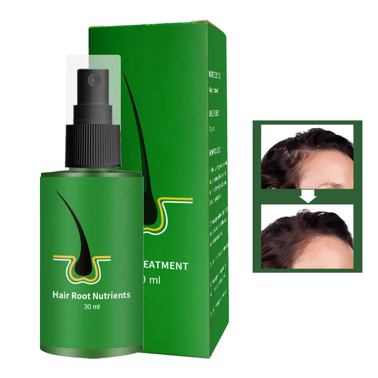 

Sdotter 30ml Hair Growth Lotion Hair Hair Care Products Root Nutrients Anti-Loss Beard Regrowth Thailand Hair Lotion