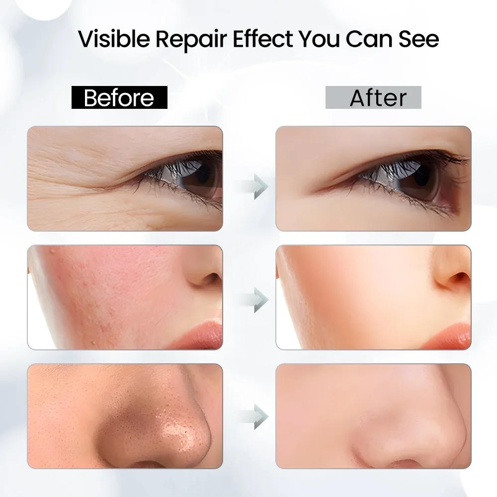 Светодиодная маска для лица Светотерапия 7-цветная фотонная Маска ухода за кожей