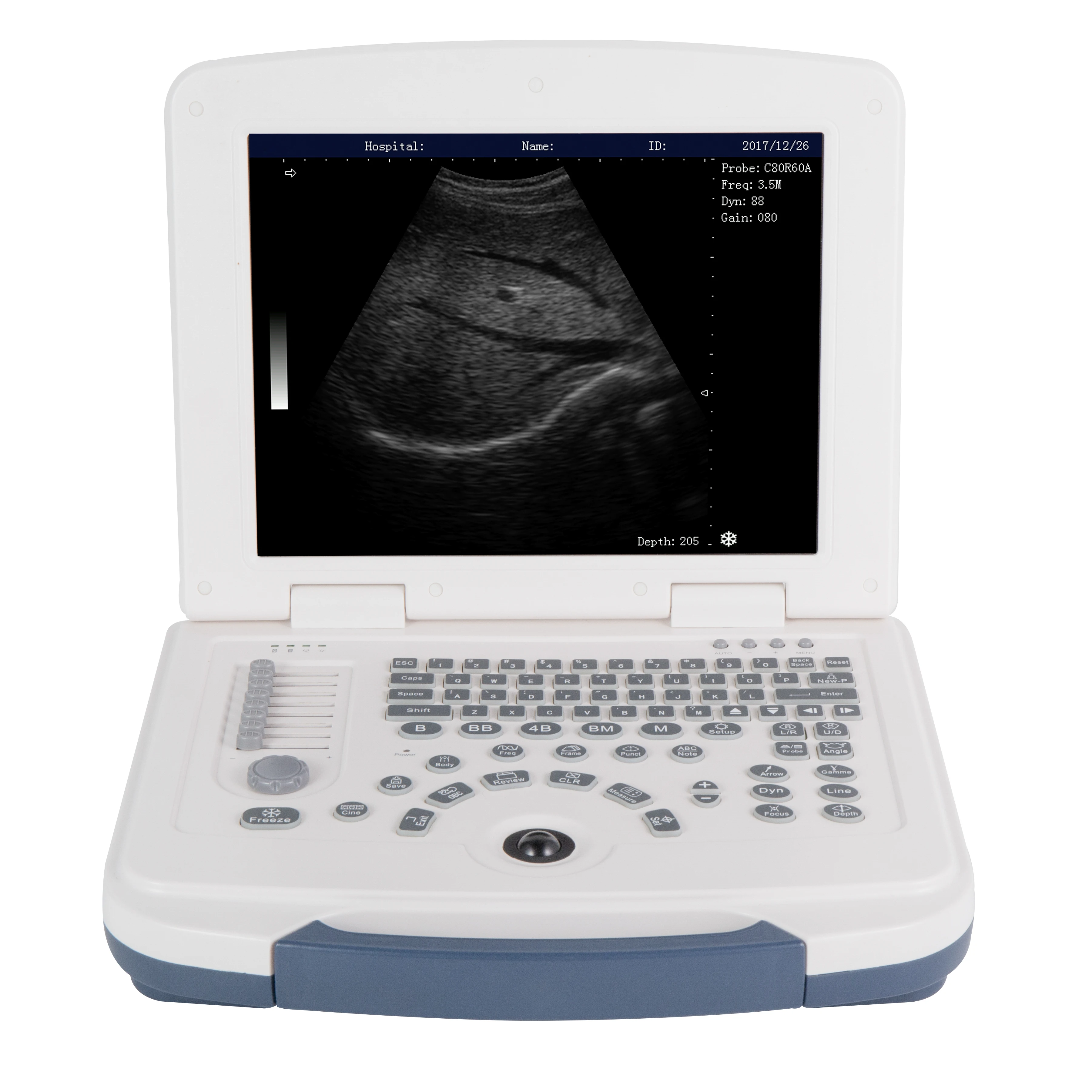 

LX-BW-L6 Portable medical ultrasound instruments ecography Mindray echo doppler ultrasound 3d gynecologic / pregnancy ultrasound