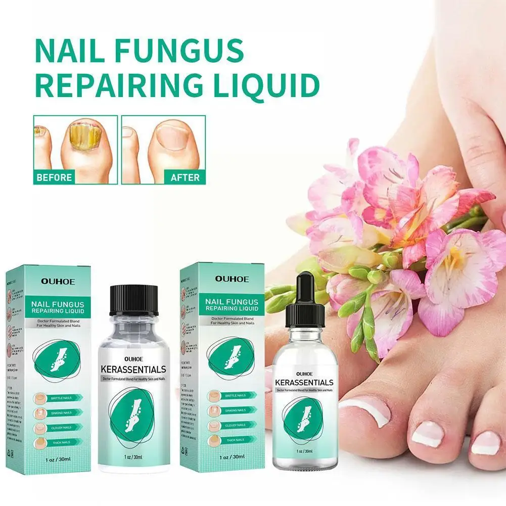 

Kerassentials For Toenail Fungus, Kerassentials Toenail Fungus Treatment Oil Nail Repair Foot Care Essence Nail Foot Whiten V5B2