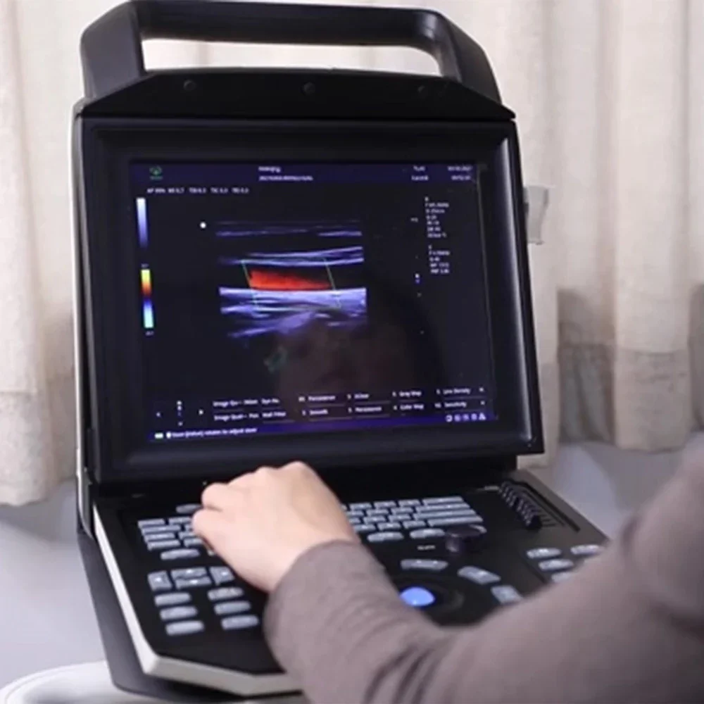 MY-A027E Mayamed портативный ноутбук ecografo ультразвуковой аппарат цветной Доплер сканер