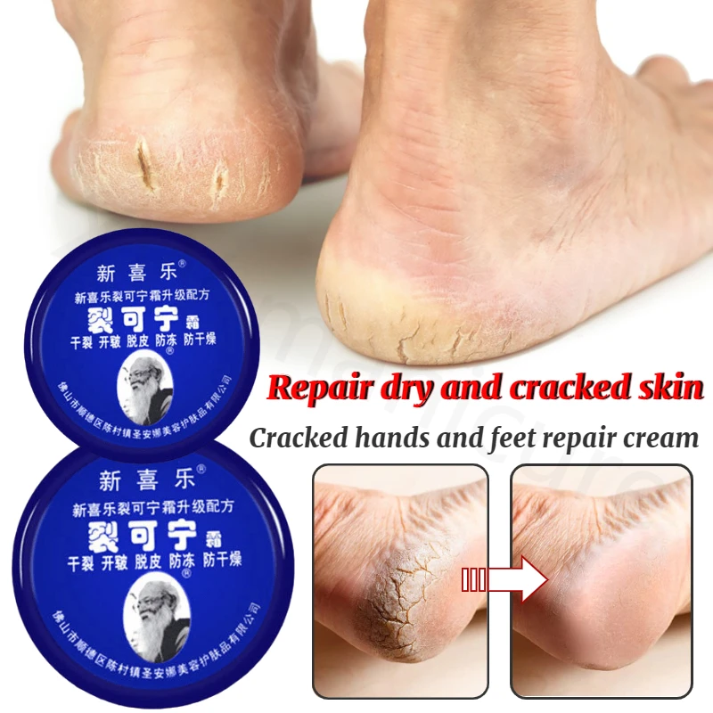 

Anti-cracking Foot Cream To Improve Dry Heels Dry Cracked Repair Cream Hands To Remove Calluses Dead Skin Hands and Feet Care