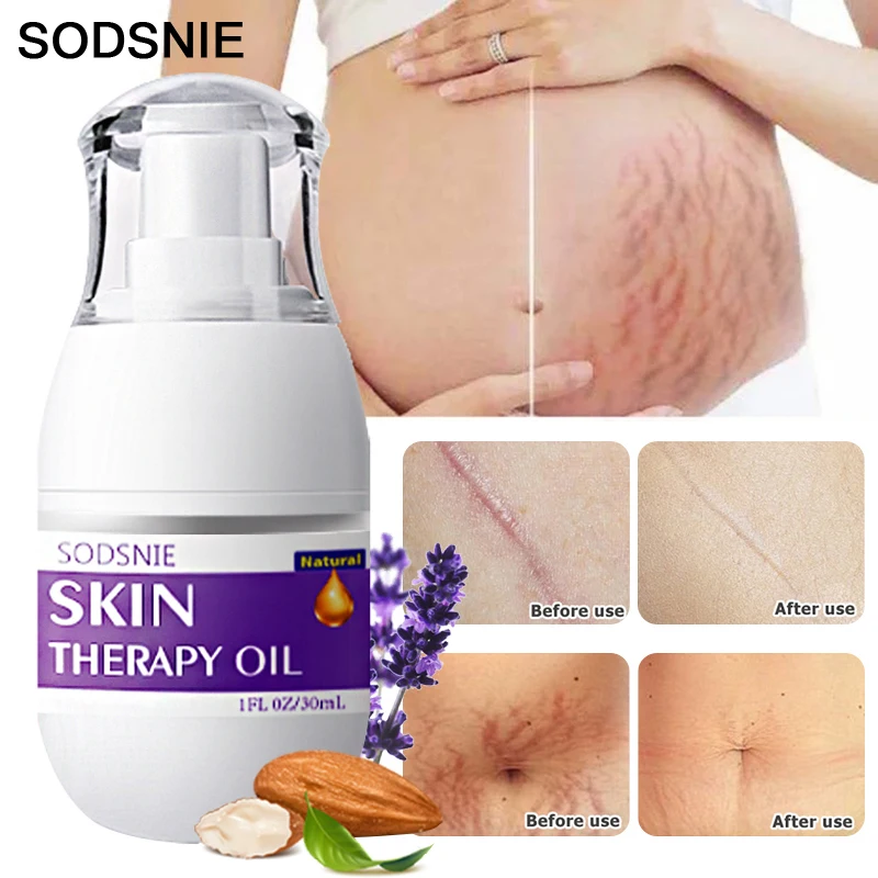 

Stretch Mark Removal Oil Repair Scar Fat lines Surgical Burns Scars Serum Firming Lifting Fade Pregnant Belly Wrinkle Oil 30ml